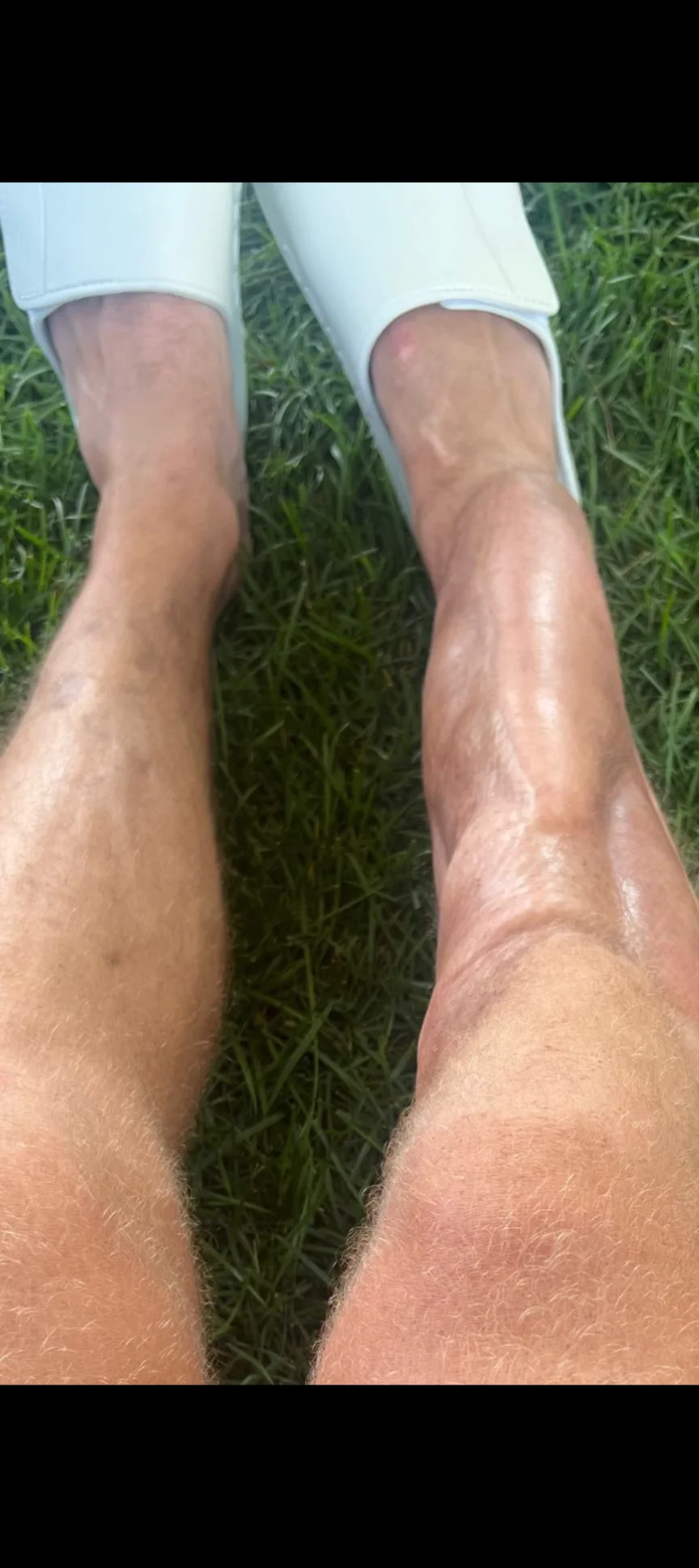 alex smith right shin