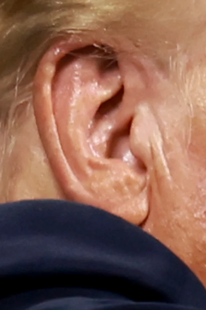 miracle of ear healing