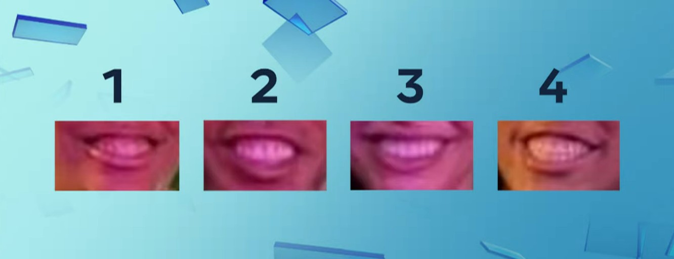 ronaldinho and nieces mouth