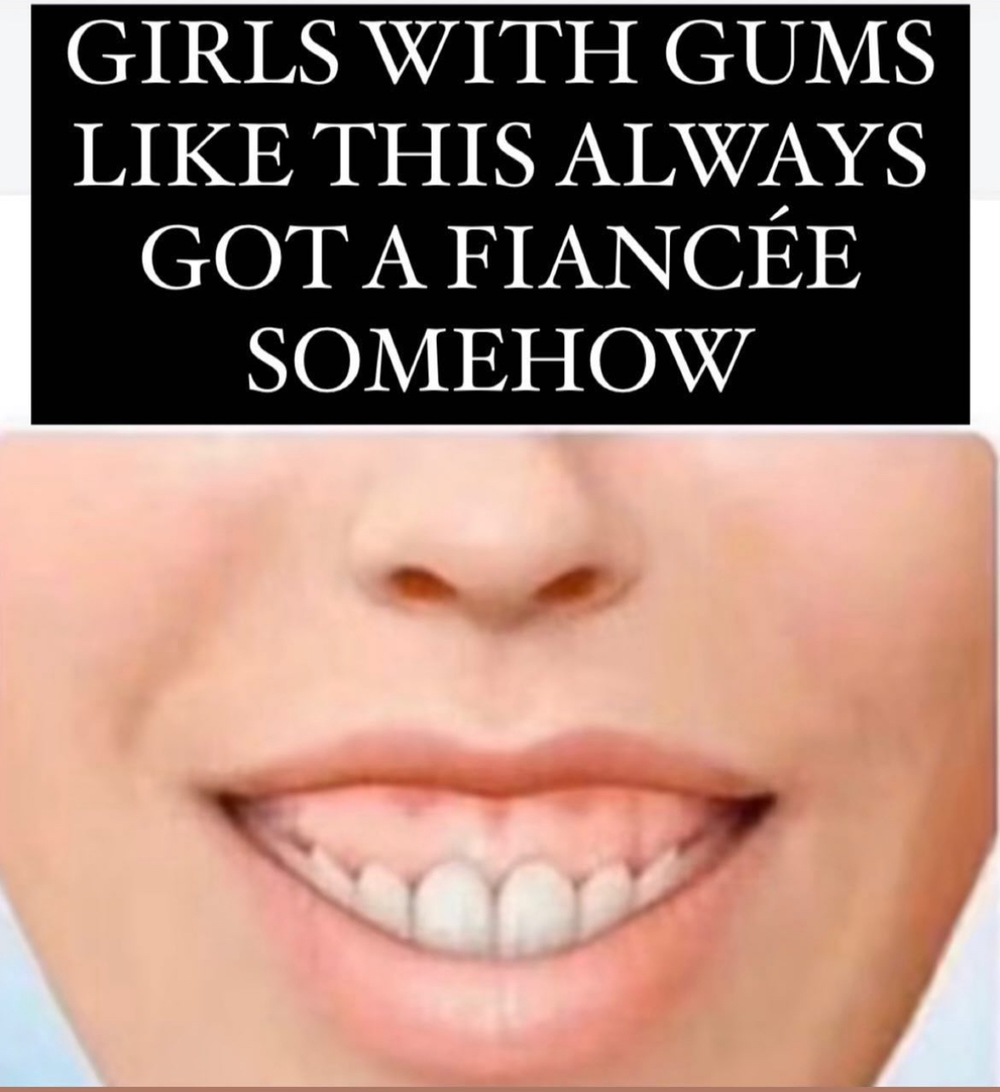 girls gums fiance